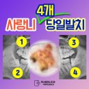 천호온사랑치과의원 | 사랑니 4개 동시발치 후기, 성남 사랑니 치과 <구강악 전문의 작성>