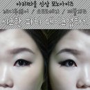 모노아이래쉬