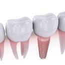 삼성덴탈 이미지