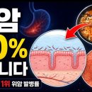 한국인 위암 발병률은 전세계 1위입니다. 이렇게 하면 위암 발병률을 90% 낮출 수 있습니다. 이미지