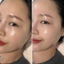 (주)에르쯔틴 | 탄력마스크팩추천 에르쯔틴 실트마스크 후기