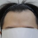 압구정모비앙의원 이미지