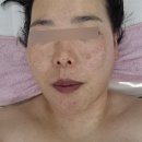 스마일에스테틱 | 바디 관리 받으러 갔다가 안색까지 살아난 날, 에코시티 스마일 에스테틱 후기
