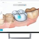 덴탈웍스 이미지