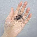 골든루트로 | 두피 샴푸 추천 바디브 마테 루트로 30대 탈모 두피관리 정수리볼륨 살린 후기