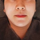 리드유스킨 | 의정부 피부관리 리프팅관리 민락동 리드유스킨
