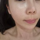 더나은스킨케어 - 김포시 김포한강11로 322 | 포항 북구 두호동 피부관리 더나은스킨 꼼꼼한 데콜데 케어 후기