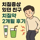 386친구들 | 치질증상 있던 친구, 치질약 2개월 사용 솔직 후기