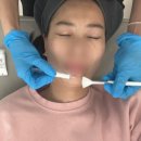 용인 처인구 피부관리 솔벨르 에스테틱 속건조 피부 애씨큘 필링 후기