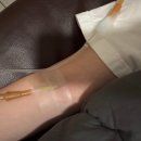 제제필라테스 | 마운자로 2.5mg 1주차 후기, 아르기닌 수액 효과