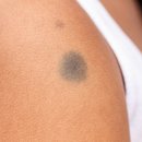 서울피부과의원 이미지