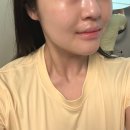 비타민 | [대구] 두류동 피부관리 비타민 이온토관리 후기 │ 룩앳더뷰티