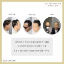 일러스라인 | 신림두피문신/신대방두피문신/정수리탈모/가르마탈모 "일러스라인SMP"