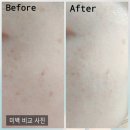 케이벨르 화이트닝 세럼 리제너레이팅 크림 :) 약을 품는 화장품으로 기미, 주근깨, 주름, 탄력 관리하기