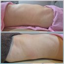 황후에스테틱 | 안산 고잔동 에스테틱 추천! 황후에서 복부관리 받고 온 후기!