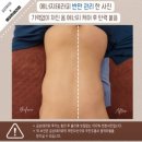 금손테라피 이미지