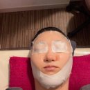 진 | 목동 에스테틱 미인본가 목동점 에서 윤곽관리받고 얼굴 갸름해진 후기