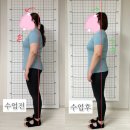 블리스 피티 엔 필라테스 스튜디오 | 대구 죽전동 필라테스 개인레슨 전문 필라테스 회원님 비포에프터 후기 [피티 스튜디오 엔 필라테스]