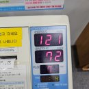 (주)세동 | 발작성 심방세동 펄스장 시술 후기 -17일차