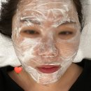 하나둘어린이집 | 부산 연제구 피부과 점, 편평사마귀 제거 후기