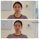(주)서울루션 | [대치 피부관리샵 추천] 에스테티아 방문 후기✨ 한 번의 관리로 이런 변화가?! 대치동 피부관리,도곡동...