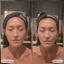 형성프라자 앞 버스정류장(2) | 볼패임 고민 광교피부관리 에스테티아 액티브리프트로 입체윤곽관리 후기