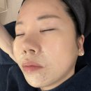 마곡 피부관리 블루밍뷰티ㅣ마곡여드름 고민 해결ㅣ인중 홍조까지후기