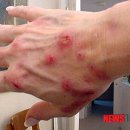 양구군보건소 이미지