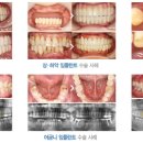 라임나무 이미지