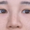 벨포인트의원 네이버블로그