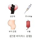 급성 바이러스성 간염(Acute viral hepatitis) 감염성 질환, 소화기질환이란? 이미지