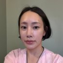 힐링센터비움 | [일산/고양] 행신역 윤곽관리 맛집 비움과채움, 처진 턱살과 팔자주름 2일 후 리얼 변화!
