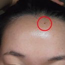 국홍일국정표피부과의원 이미지