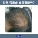 헤어증모하다