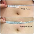 용민로 | 성형안해도 청초 의정부 퀸즈뷰티 :: 민락동 다이어트 뱃살 복부관리 후기