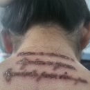 디아트의원 | 청주 디아트의원 문신제거 후기. (1회~4회차)