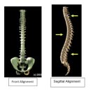 고려보조기 이미지