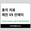 케이플란트 치과기공소 | 소하동치과 케이플란트ㅣ충치 치료, 레진 VS 인레이