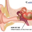 이편한보청기 일산센터 이미지
