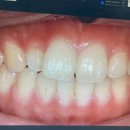 강남더블유치과의원 이미지