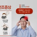 뇌졸중 이미지