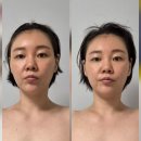 자연피부관리실 | 대구 달서구 청아피부체형관리실 두골비비대칭 관리 후기｜신부관리 윤곽관리 받고 느낀 변화