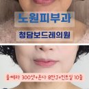 노원피부과 청담보드레의원에서 리프팅으로 10년 젊어지게한 후기 및 부작용 (울쎄라+온다+민트실)