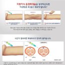 남성수술 후기