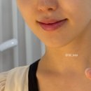 아이올라 - 북구 동암로38길 11 | 중랑구 피부관리 잘하는 곳 '아이올라' | 수분, 리프팅 케어 후기