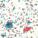 인터메디칼 이미지