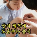 상처 회복에 도움주는 음식 이미지