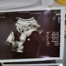 (주)로터스블랑 | 월간일기 : 임신 9개월 임산부 일상