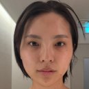 탑클래스성형외과의원 | 신논현역성형외과 얼굴지방분해주사 윤곽주사 튠페이스 가격 통증 솔직후기