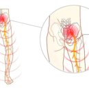 올인원피티앤테라피 이미지